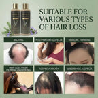 Rosemary Hair Growth Shampoo with Hydrolyzed Keratin 114gm Each (Pack of 2)